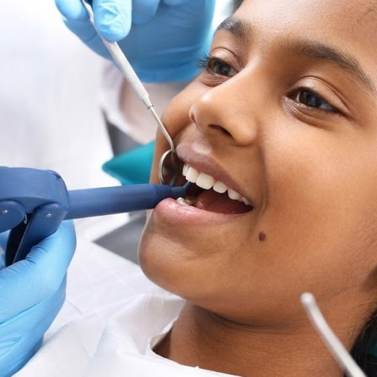 Fluoride Application